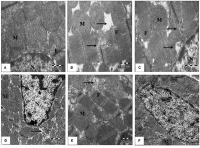 Corrigendum: Seabuckthorn Pulp Oil Protects against Myocardial Ischemia–Reperfusion Injury in Rats through Activation of Akt/eNOS